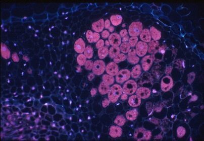 Clover nodule section stained with propidium iodide